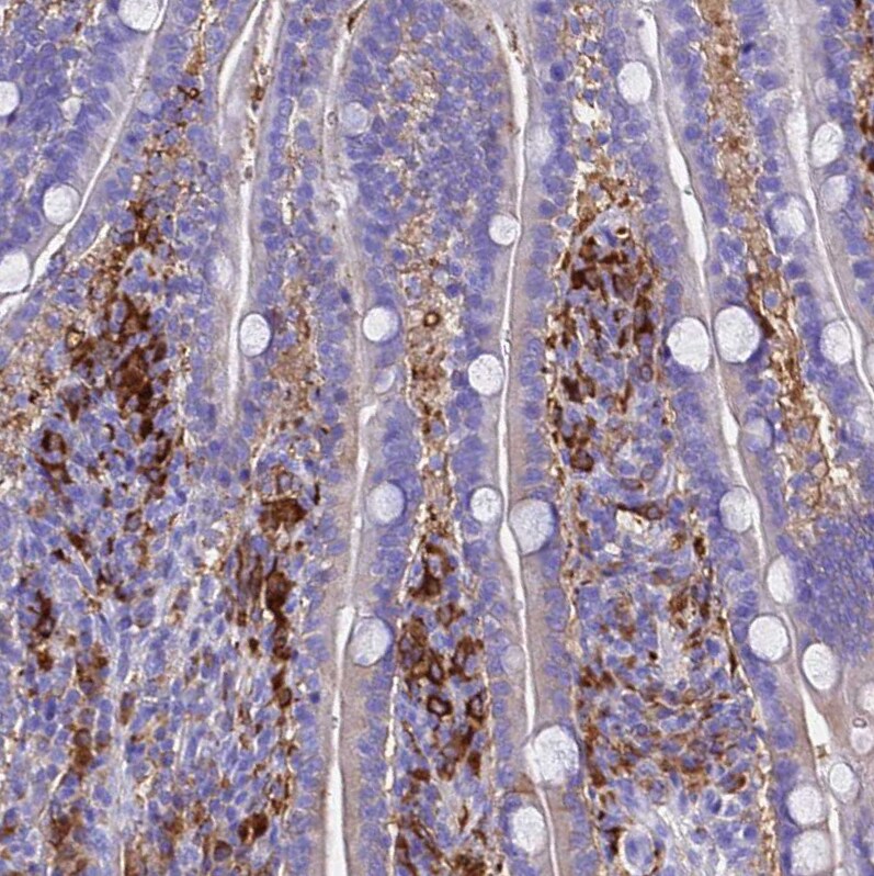 Ferritin Light Chain Antibody - BSA Free Immunohistochemistry-Paraffin: Ferritin Light Chain Antibody [NBP2-34072]
