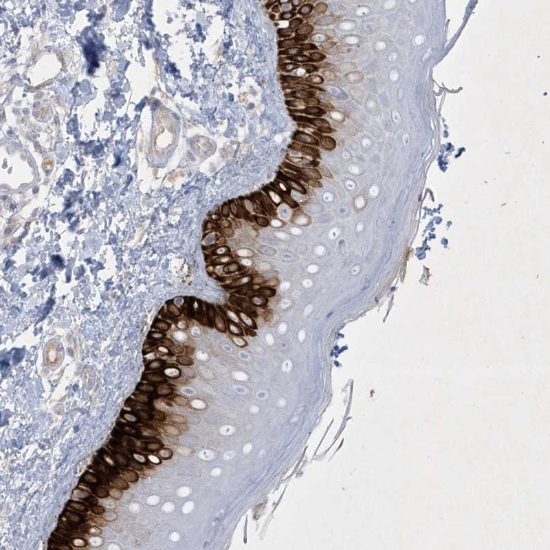 CCDC24 Antibody - BSA Free Immunohistochemistry-Paraffin: CCDC24 Antibody [NBP2-34179]
