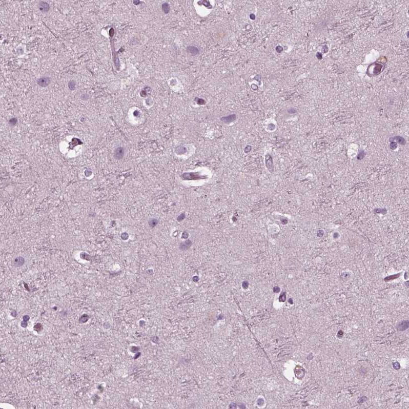 Chorionic Gonadotropin alpha Chain (hCG alpha) Antibody - BSA Free Immunohistochemistry-Paraffin: Chorionic Gonadotropin alpha Chain (hCG alpha) Antibody [NBP2-34183]