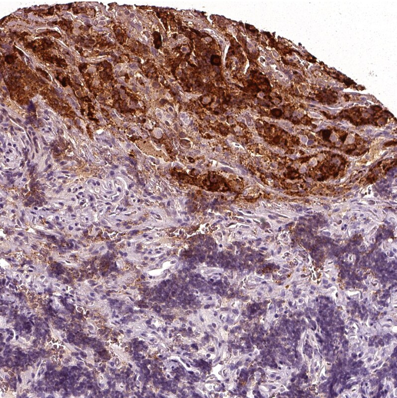 Chorionic Gonadotropin alpha Chain (hCG alpha) Antibody - BSA Free Immunohistochemistry-Paraffin: Chorionic Gonadotropin alpha Chain (hCG alpha) Antibody [NBP2-34183]