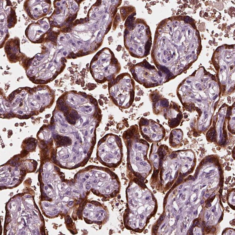Chorionic Gonadotropin alpha Chain (hCG alpha) Antibody - BSA Free Immunohistochemistry-Paraffin: Chorionic Gonadotropin alpha Chain (hCG alpha) Antibody [NBP2-34183]
