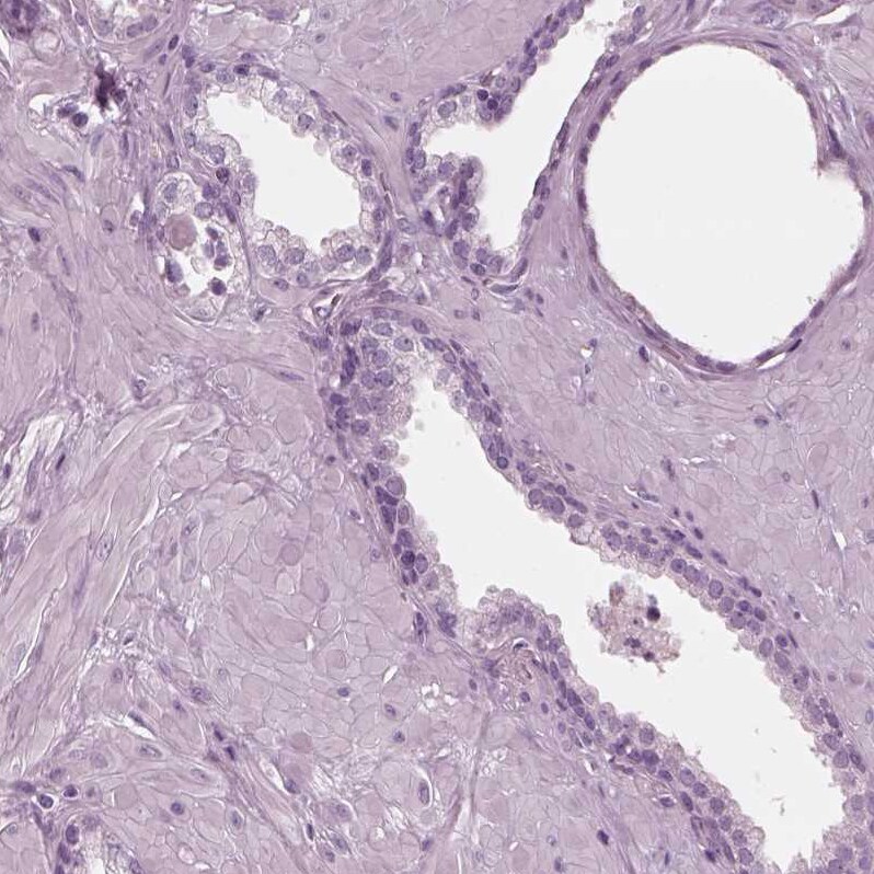 Chorionic Gonadotropin alpha Chain (hCG alpha) Antibody - BSA Free Immunohistochemistry-Paraffin: Chorionic Gonadotropin alpha Chain (hCG alpha) Antibody [NBP2-34183]