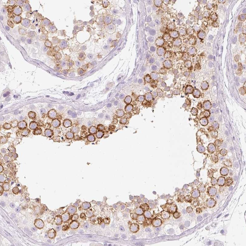 TSP50 Antibody - BSA Free Immunohistochemistry: TSP50 Antibody - BSA Free [NBP2-34204]