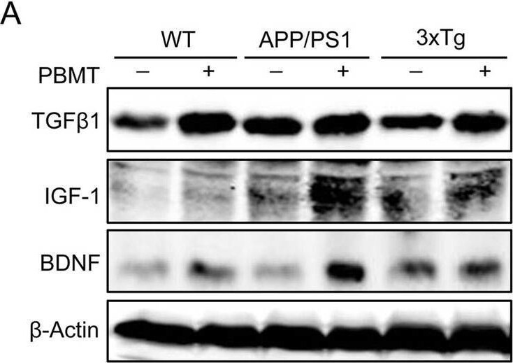 IGF-I/IGF-1 Antibody (M23)