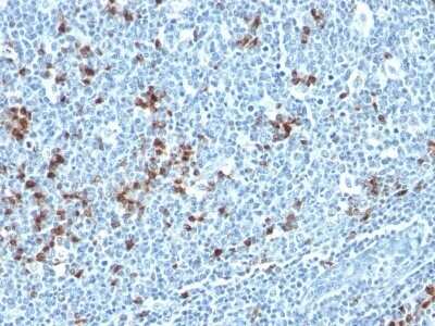 Kappa Light Chain Antibody (HP6053 + L1C1)