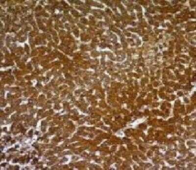 Hepatocyte Specific Antigen Antibody (OCH1E5)