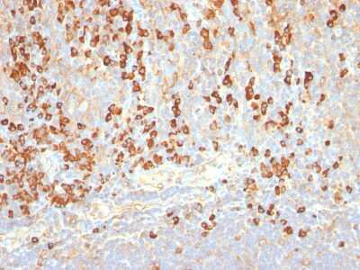 Plasma Cell Marker Antibody (SPM310)