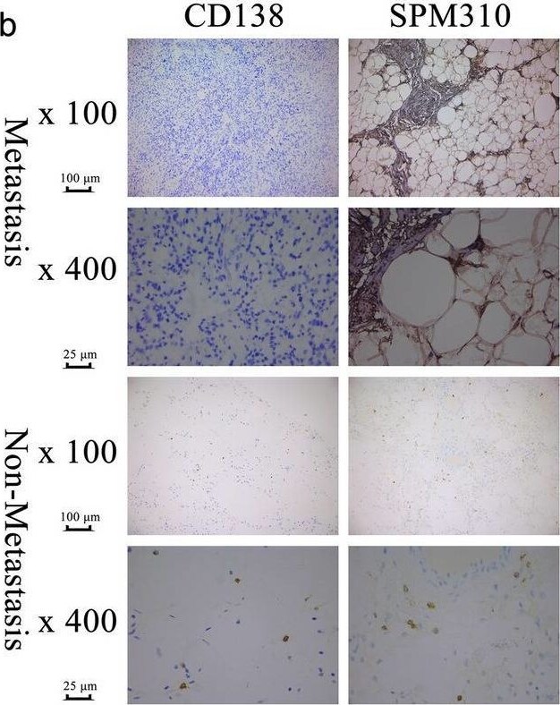 Plasma Cell Marker Antibody (SPM310)