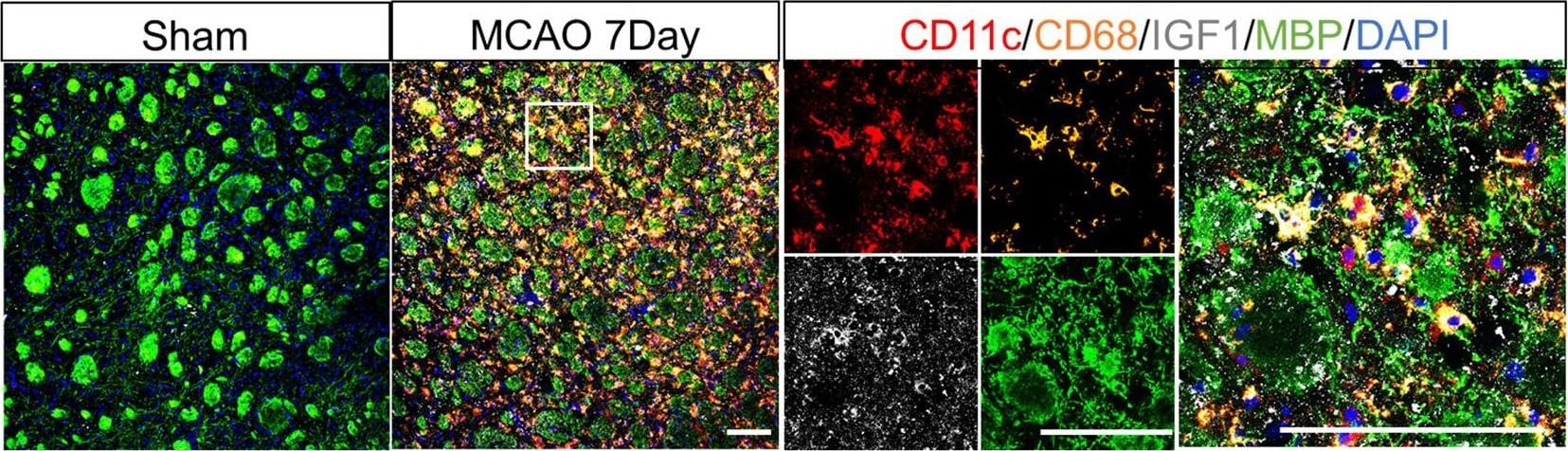 IGF-I/IGF-1 Antibody (SPM406)