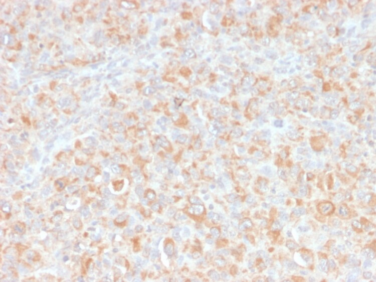 TNF-alpha Antibody (SPM543) - Azide and BSA Free Immunohistochemistry-Paraffin: TNF-alpha Antibody (SPM543) - Azide and BSA Free [NBP2-34419] -