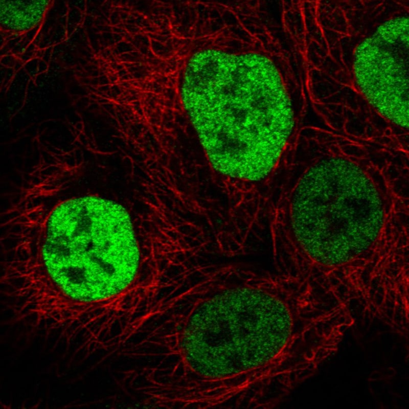 p53 Antibody (CL2199) - BSA Free Immunocytochemistry/ Immunofluorescence: p53 Antibody (CL2199) [NBP2-34495]