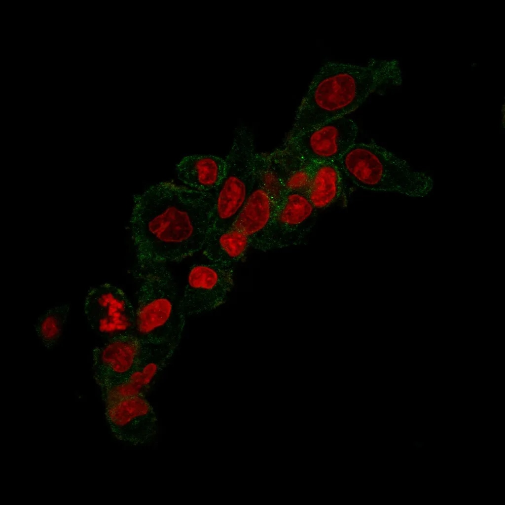 ErbB2/Her2 Antibody (HRB2/258) - Azide and BSA Free Immunocytochemistry/ Immunofluorescence: ErbB2/Her2 Antibody (HRB2/258) - Azide and BSA Free [NBP2-34641] -