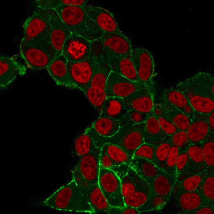 ErbB2/Her2 Antibody (HRB2/282) - Azide and BSA Free Immunocytochemistry/ Immunofluorescence: ErbB2/Her2 Antibody (HRB2/282) - Azide and BSA Free [NBP2-34642] -