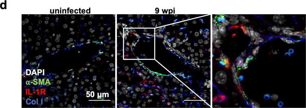 alpha-Smooth Muscle Actin Antibody (SPM332) [Allophycocyanin]