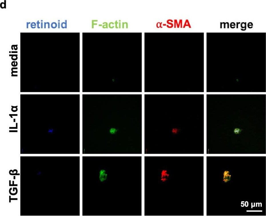alpha-Smooth Muscle Actin Antibody (SPM332) [Allophycocyanin]