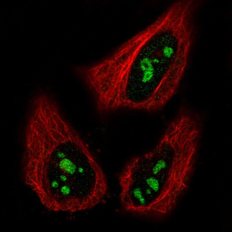 NIFK Antibody (CL2240) - BSA Free Immunocytochemistry/ Immunofluorescence: NIFK Antibody (CL2240) [NBP2-36749]