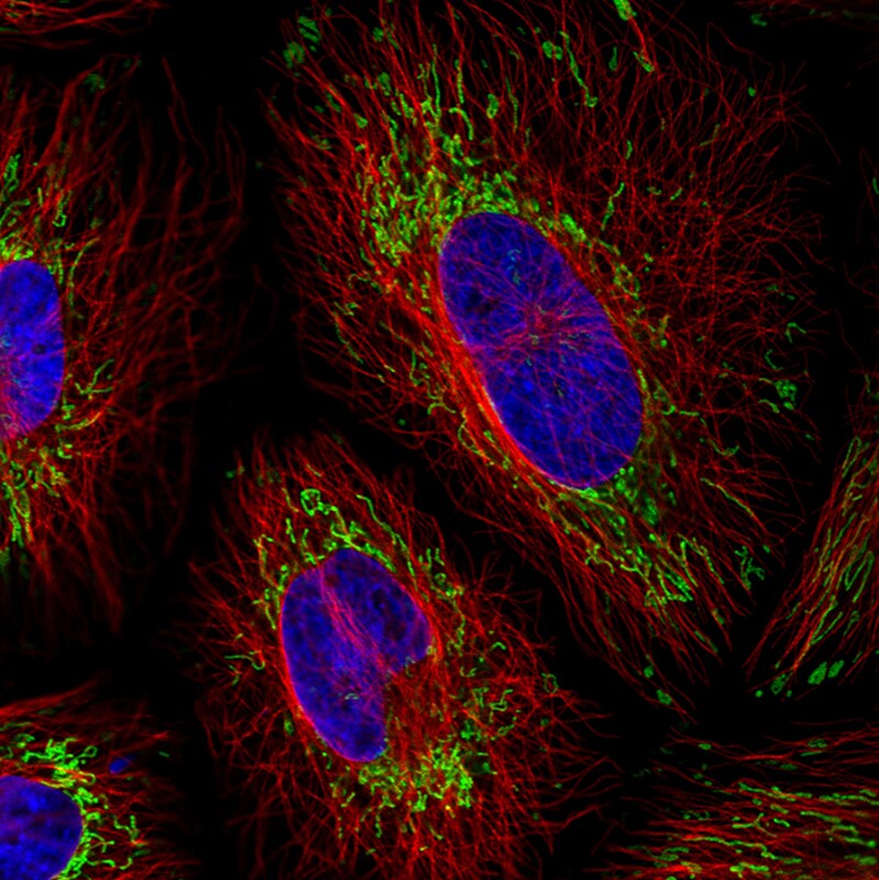 TUFM Antibody (CL2245) - BSA Free Immunocytochemistry/ Immunofluorescence: TUFM Antibody (CL2245) [NBP2-36753]