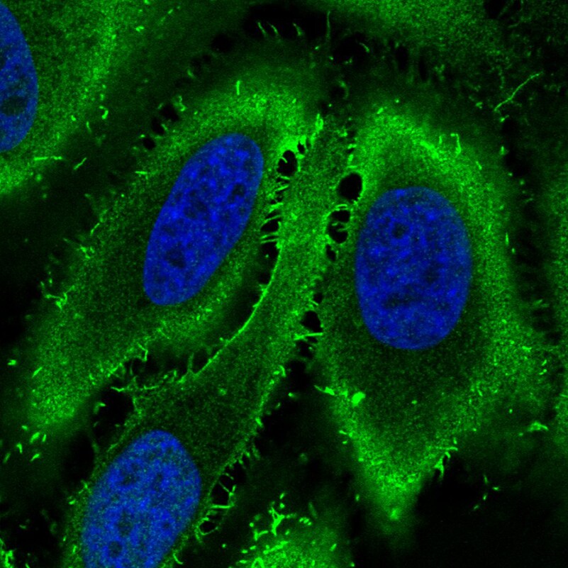 Ezrin Antibody (CL2384) - BSA Free Immunocytochemistry/ Immunofluorescence: Ezrin Antibody (CL2384) [NBP2-36760]