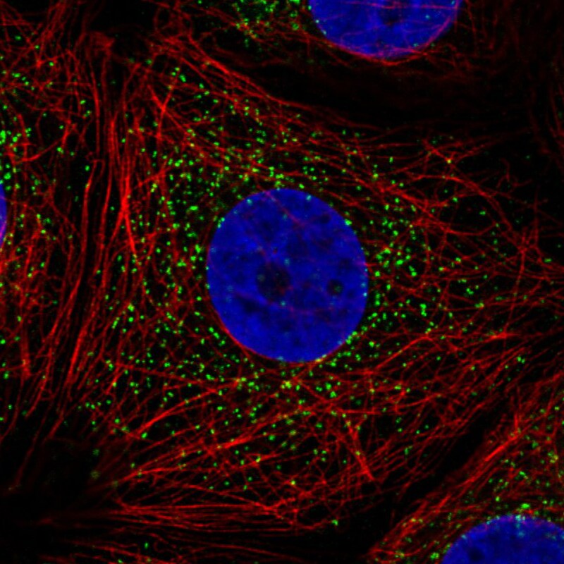 PMP70 Antibody (CL2524) - BSA Free Immunocytochemistry/ Immunofluorescence: PMP70 Antibody (CL2524) [NBP3-52459]