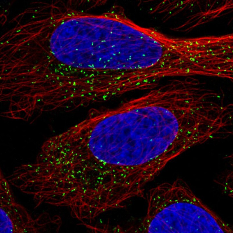 PMP70 Antibody (CL2524) - BSA Free Immunocytochemistry/ Immunofluorescence: PMP70 Antibody (CL2524) [NBP3-52459]