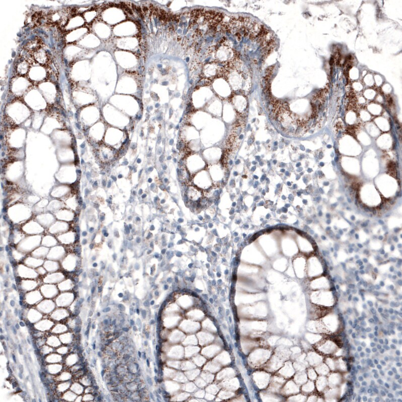 PMP70 Antibody (CL2524) - BSA Free Immunohistochemistry: PMP70 Antibody (CL2524) [NBP3-52459]
