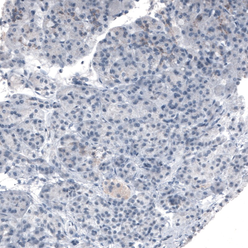 PMP70 Antibody (CL2524) - BSA Free Immunohistochemistry: PMP70 Antibody (CL2524) [NBP3-52459]