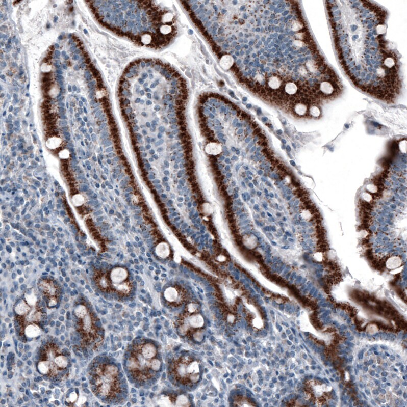 PMP70 Antibody (CL2524) - BSA Free Immunohistochemistry: PMP70 Antibody (CL2524) [NBP3-52459]