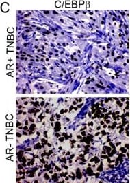 CEBP Beta Antibody (3H9)