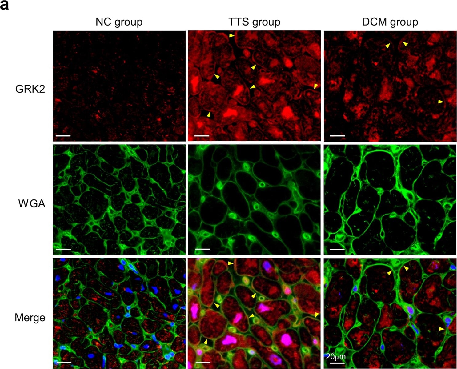 GRK2 Antibody (3F8) - BSA Free