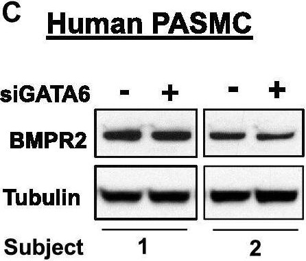 BMPR-II Antibody (3F6)