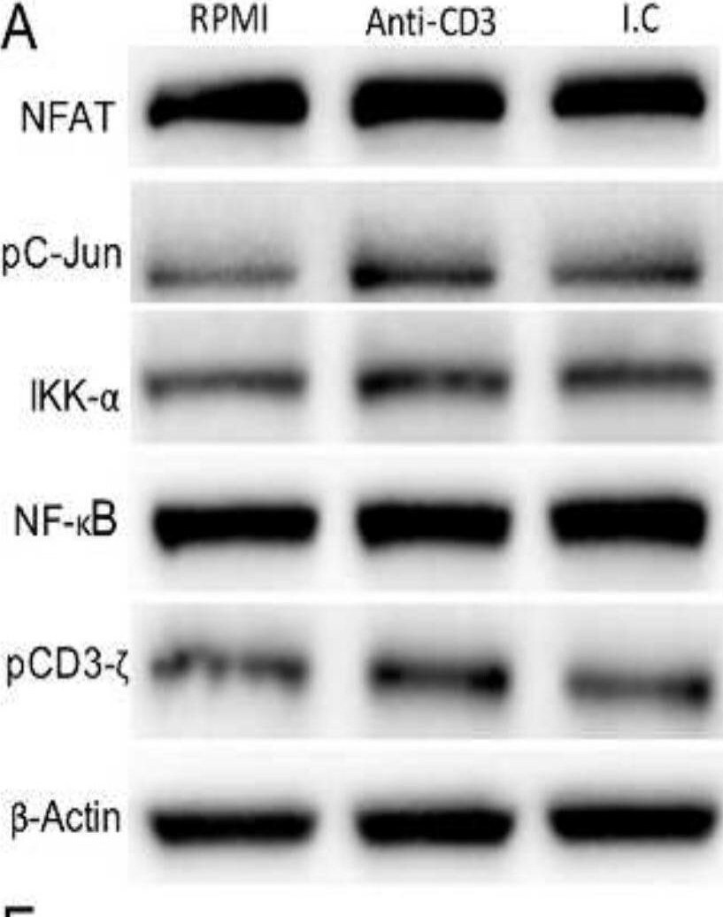 CD3 zeta [p Tyr142] Antibody (EM-54) - BSA Free
