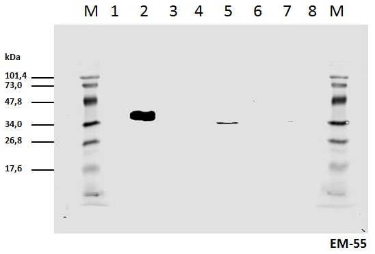 CD3 zeta [p Tyr111] Antibody (EM-55) - BSA Free Flow Cytometry: CD3 zeta [p Tyr111] Antibody (EM-55) - BSA Free [NBP2-37709]