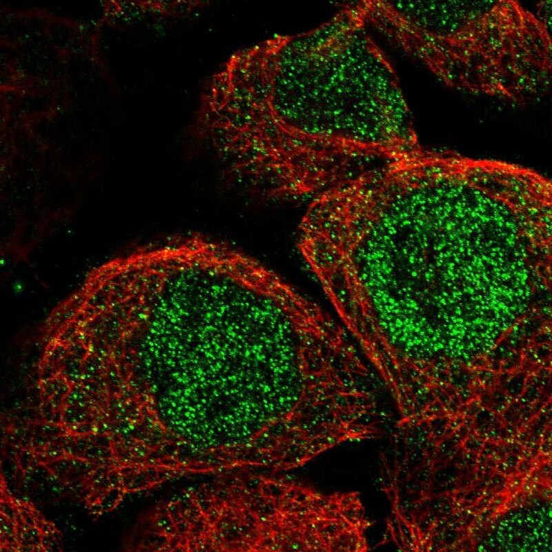 Nocturnin Antibody - BSA Free Immunocytochemistry/ Immunofluorescence: Nocturnin Antibody [NBP2-37856]