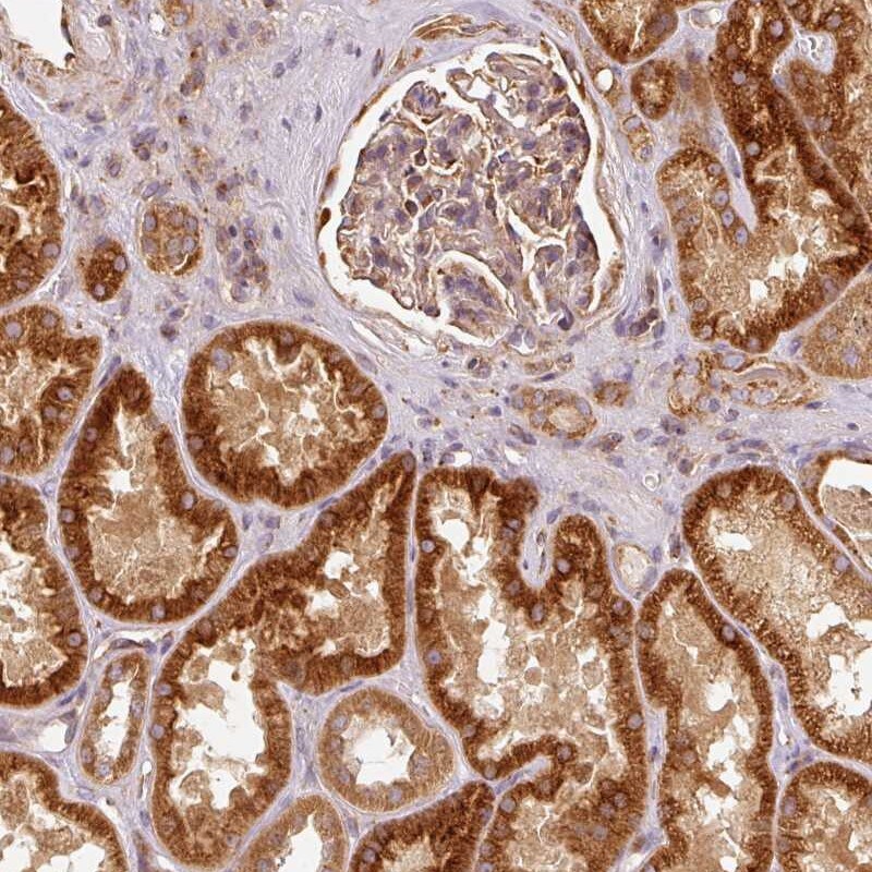 MTHFD1L Antibody - BSA Free Immunohistochemistry-Paraffin: MTHFD1L Antibody [NBP2-37863]
