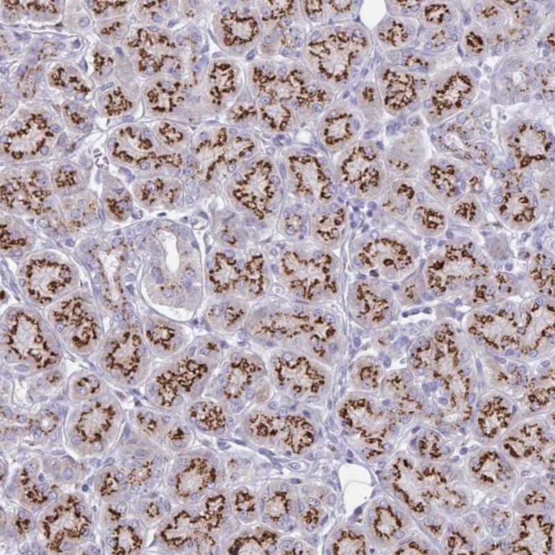 SDNSF/MCFD2 Antibody - BSA Free Immunohistochemistry: SDNSF/MCFD2 Antibody - BSA Free [NBP2-37873]