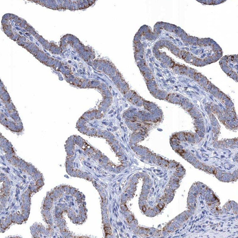 TTC21B Antibody - BSA Free Immunohistochemistry-Paraffin: TTC21B Antibody [NBP2-37876]
