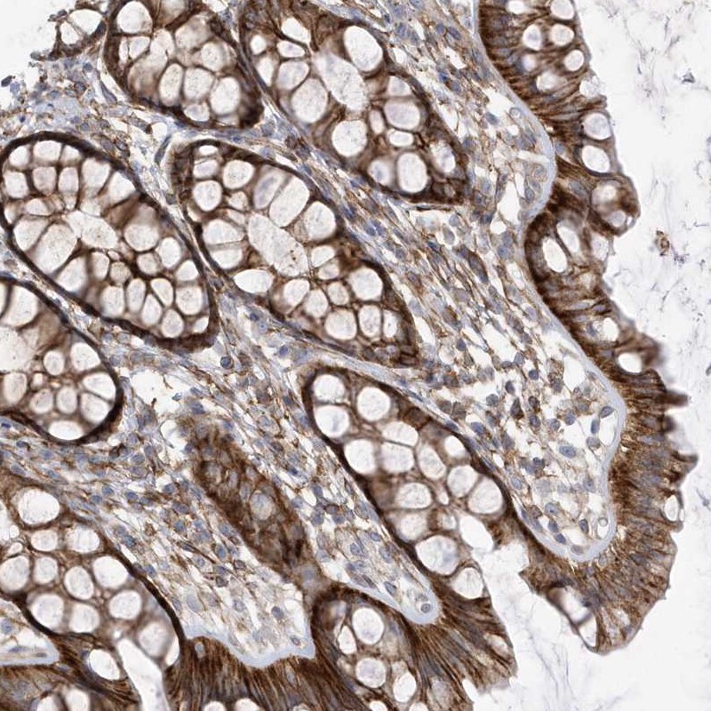 Apc1 Antibody - BSA Free Immunohistochemistry: Apc1 Antibody - BSA Free [NBP2-37880]