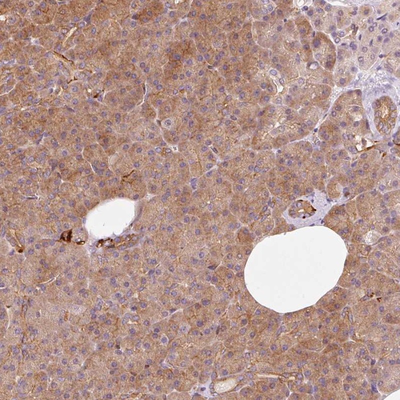 IQGAP2 Antibody - BSA Free Immunohistochemistry: IQGAP2 Antibody - BSA Free [NBP2-37884]