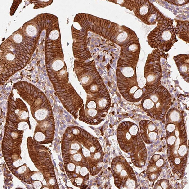 IQGAP2 Antibody - BSA Free Immunohistochemistry-Paraffin: IQGAP2 Antibody [NBP2-37885]