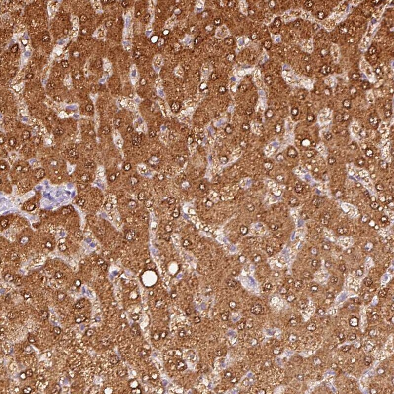 IQGAP2 Antibody - BSA Free Immunohistochemistry-Paraffin: IQGAP2 Antibody [NBP2-37885]