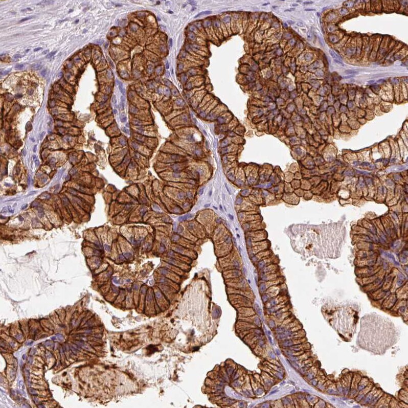 IQGAP2 Antibody - BSA Free Immunohistochemistry-Paraffin: IQGAP2 Antibody [NBP2-37885]