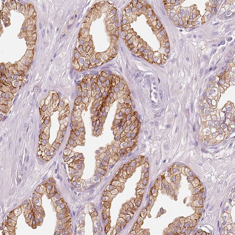 IQGAP2 Antibody - BSA Free Immunohistochemistry-Paraffin: IQGAP2 Antibody [NBP2-37885]