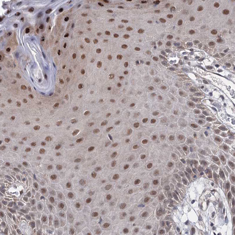 S5a/Angiocidin Antibody - BSA Free Immunohistochemistry-Paraffin: S5a/Angiocidin Antibody [NBP2-37888]