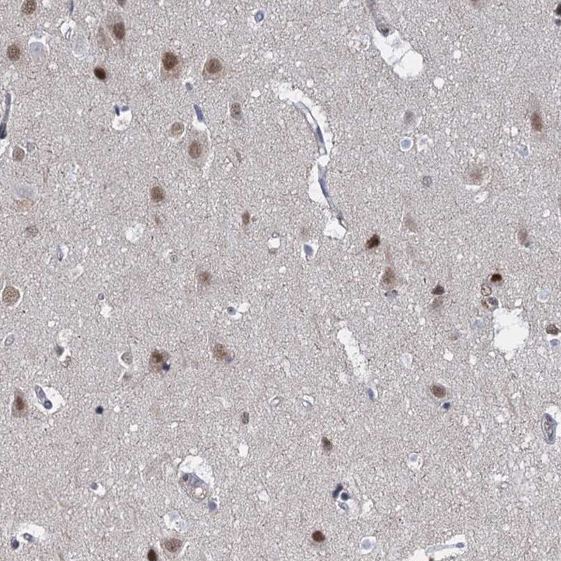 S5a/Angiocidin Antibody - BSA Free Immunohistochemistry-Paraffin: S5a/Angiocidin Antibody [NBP2-37888]