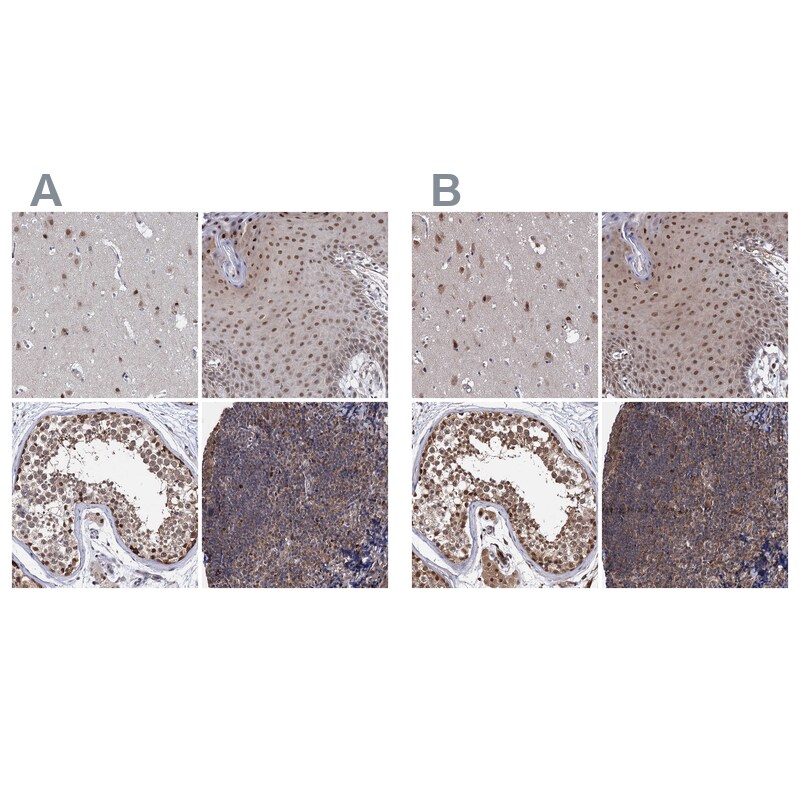 S5a/Angiocidin Antibody - BSA Free Immunohistochemistry-Paraffin: S5a/Angiocidin Antibody [NBP2-37888]