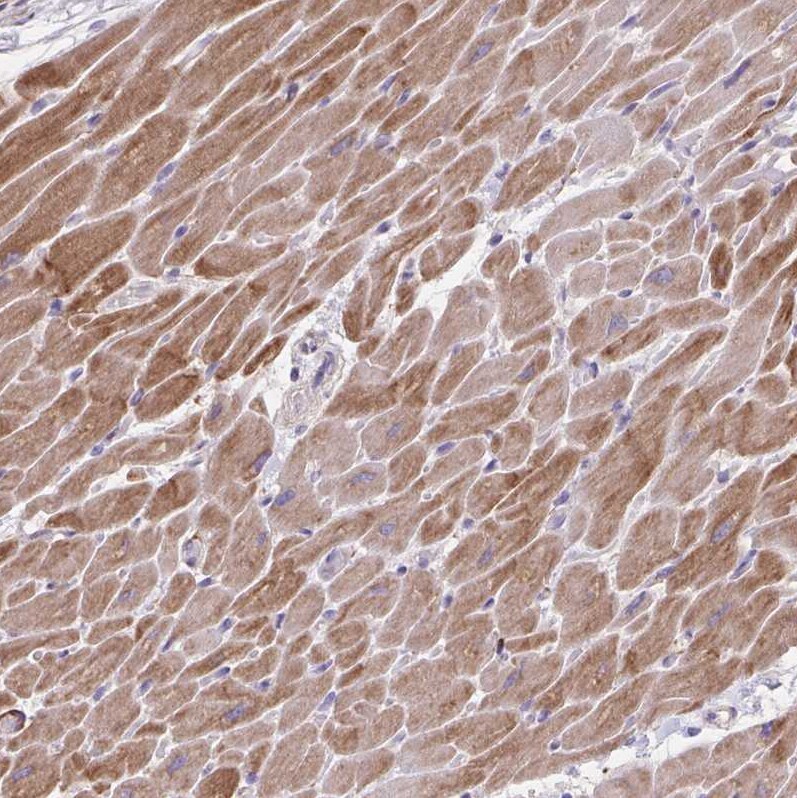 alpha Desmuslin Antibody - BSA Free Immunohistochemistry-Paraffin: alpha Desmuslin Antibody [NBP2-37892]