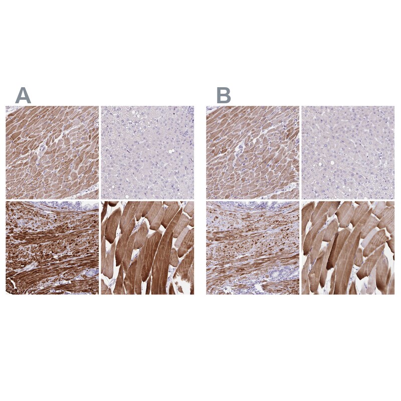 alpha Desmuslin Antibody - BSA Free Immunohistochemistry-Paraffin: alpha Desmuslin Antibody [NBP2-37892]