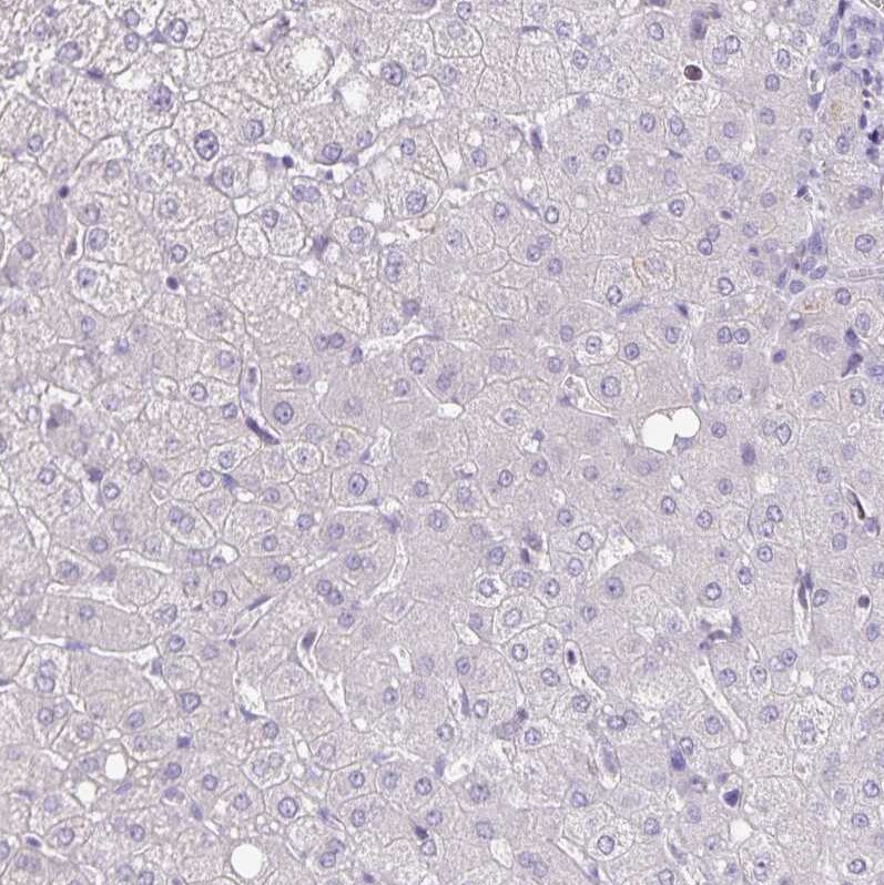 alpha Desmuslin Antibody - BSA Free Immunohistochemistry-Paraffin: alpha Desmuslin Antibody [NBP2-37892]