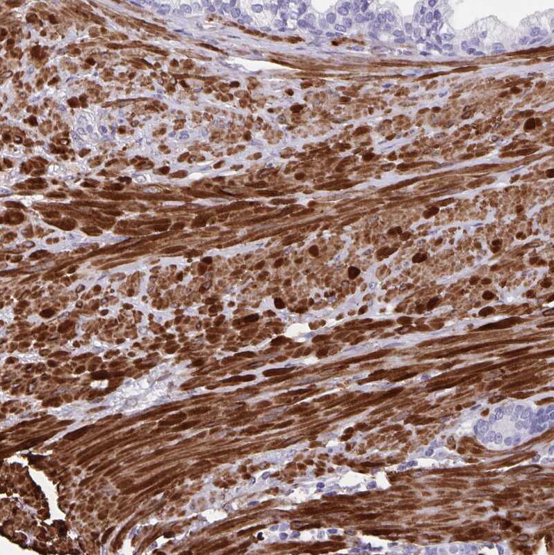 alpha Desmuslin Antibody - BSA Free Immunohistochemistry-Paraffin: alpha Desmuslin Antibody [NBP2-37892]