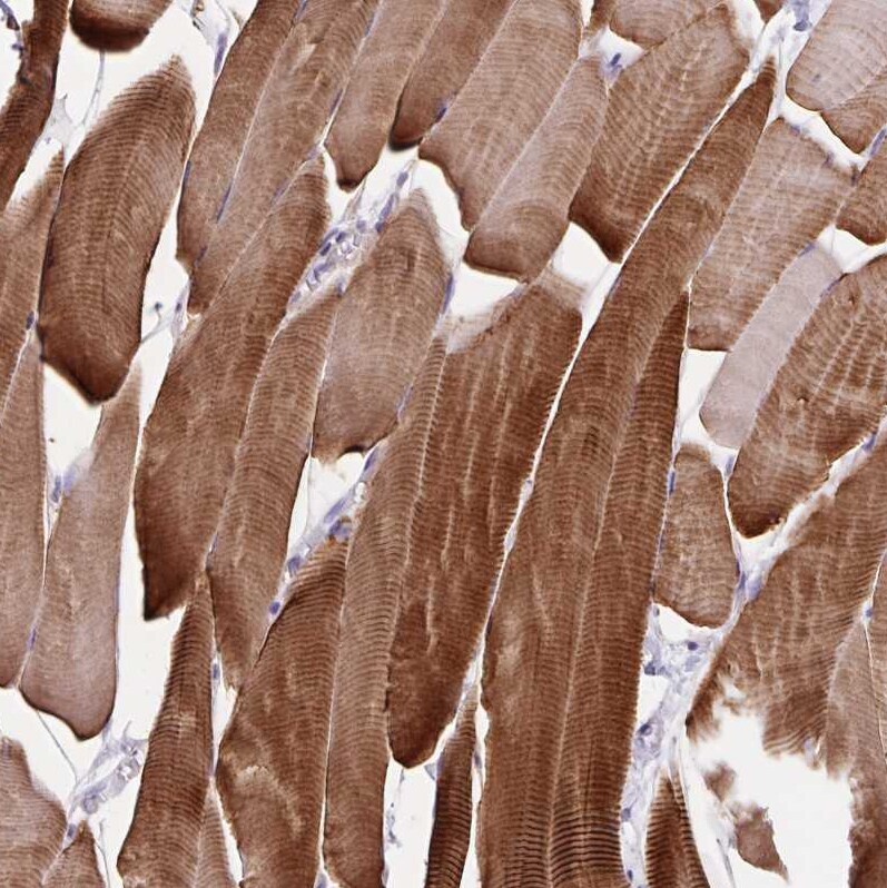 alpha Desmuslin Antibody - BSA Free Immunohistochemistry-Paraffin: alpha Desmuslin Antibody [NBP2-37892]